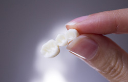 Woman holding a dental bridge