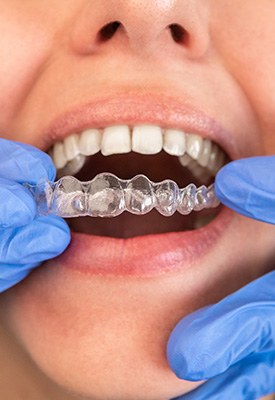 Woman getting Invisalign
