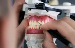 dentures being fabricated in a dental lab