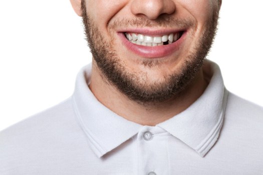 A man with a missing tooth