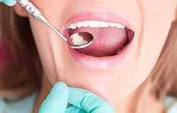 Closeup of patient during dental exam