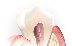 Animation of inside of tooth