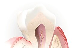 Animation of inside of tooth