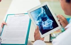 X-ray of jaw and skull bone