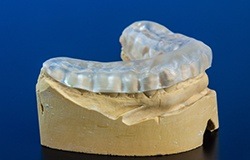 Model smile with occlusal splint