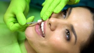 a woman having porcelain veneers placed