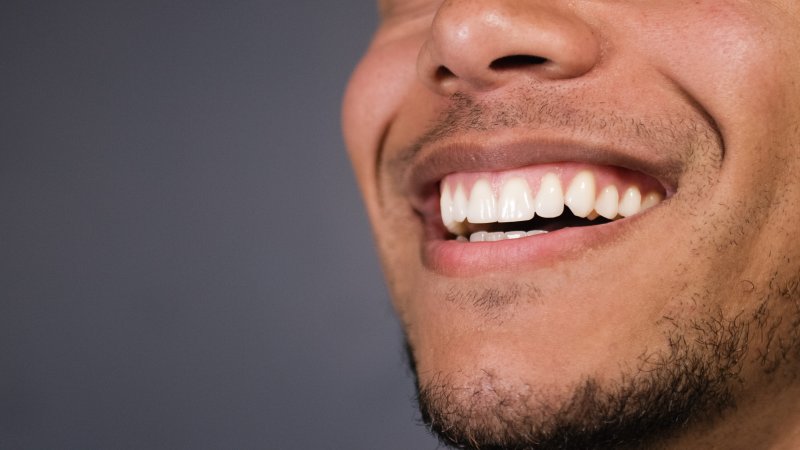 Man after cosmetic dentistry