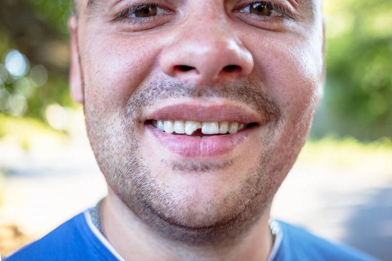A man with a chipped tooth in Orange Park