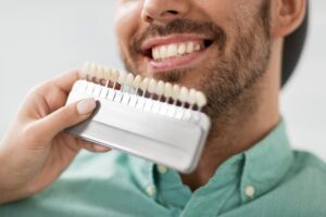 Holding veneer model up to patient's smile.