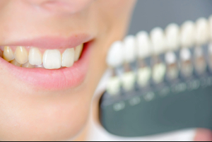Close-up of smile with discolored teeth near back